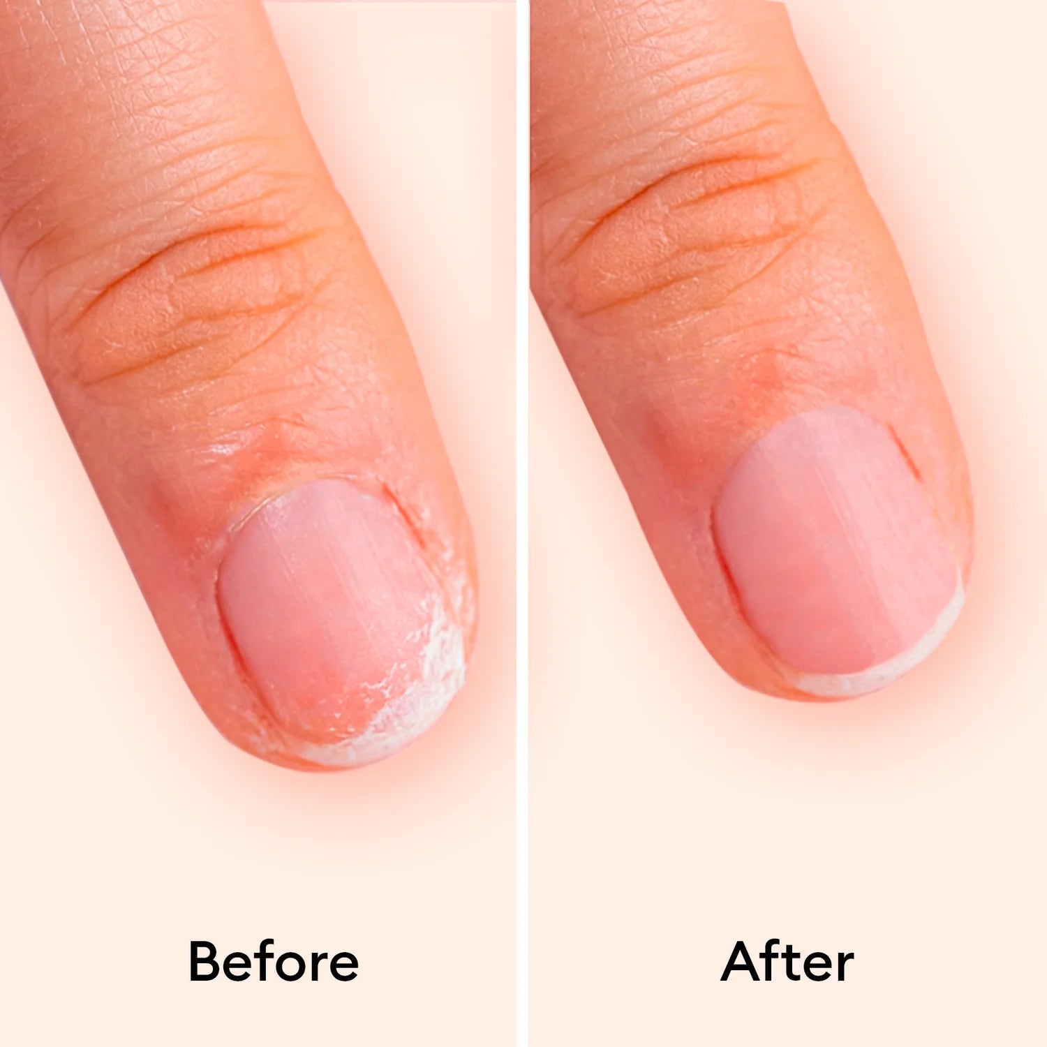 Before and after comparison of a fingernail with a white patch on a light pink background.