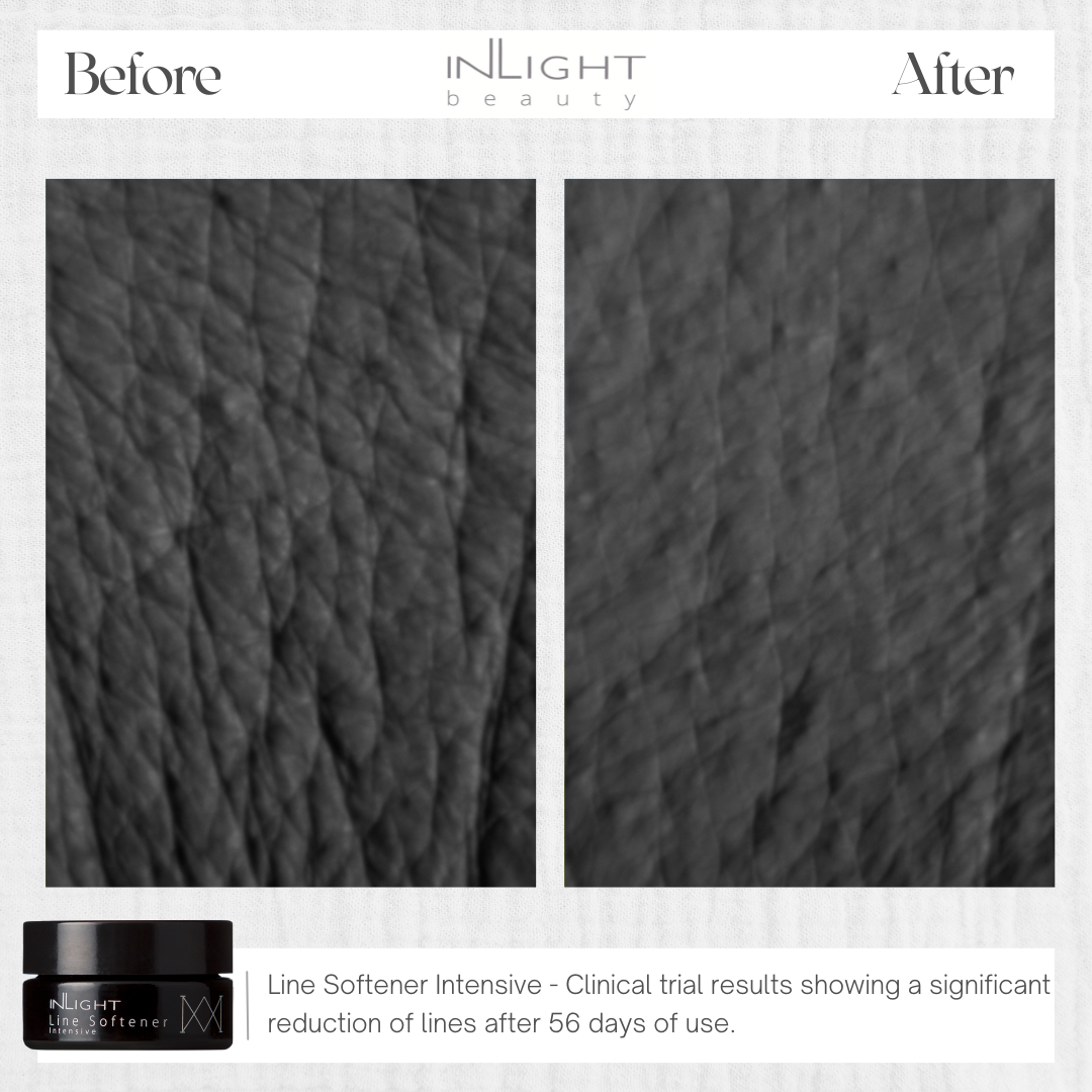 Photos of the results of the Inlight Line Softener Intensive after 56 days of use