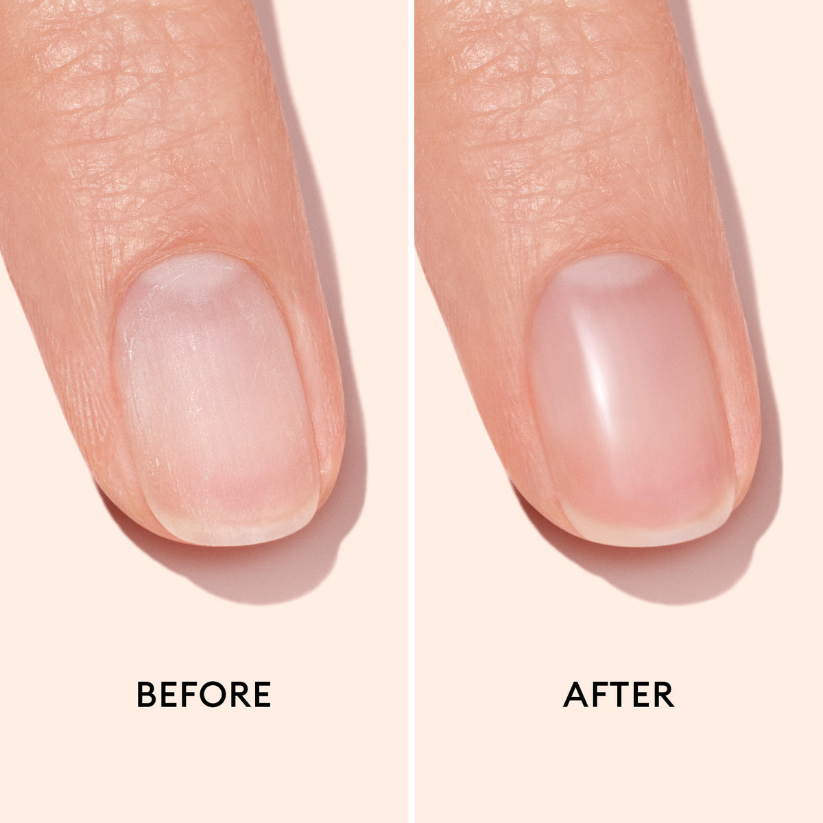 Before and after comparison of a manicured nail cured by peeling glycolique on a plain background